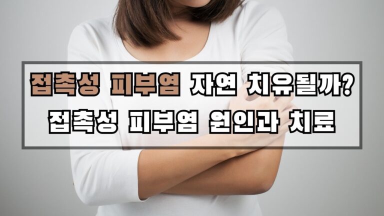 접촉성 피부염 자연 치유될까? 접촉성 피부염 원인과 치료