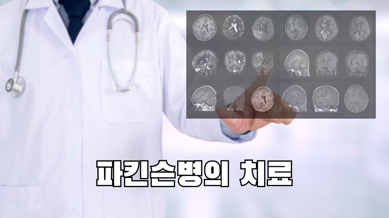 파킨슨병의 치료