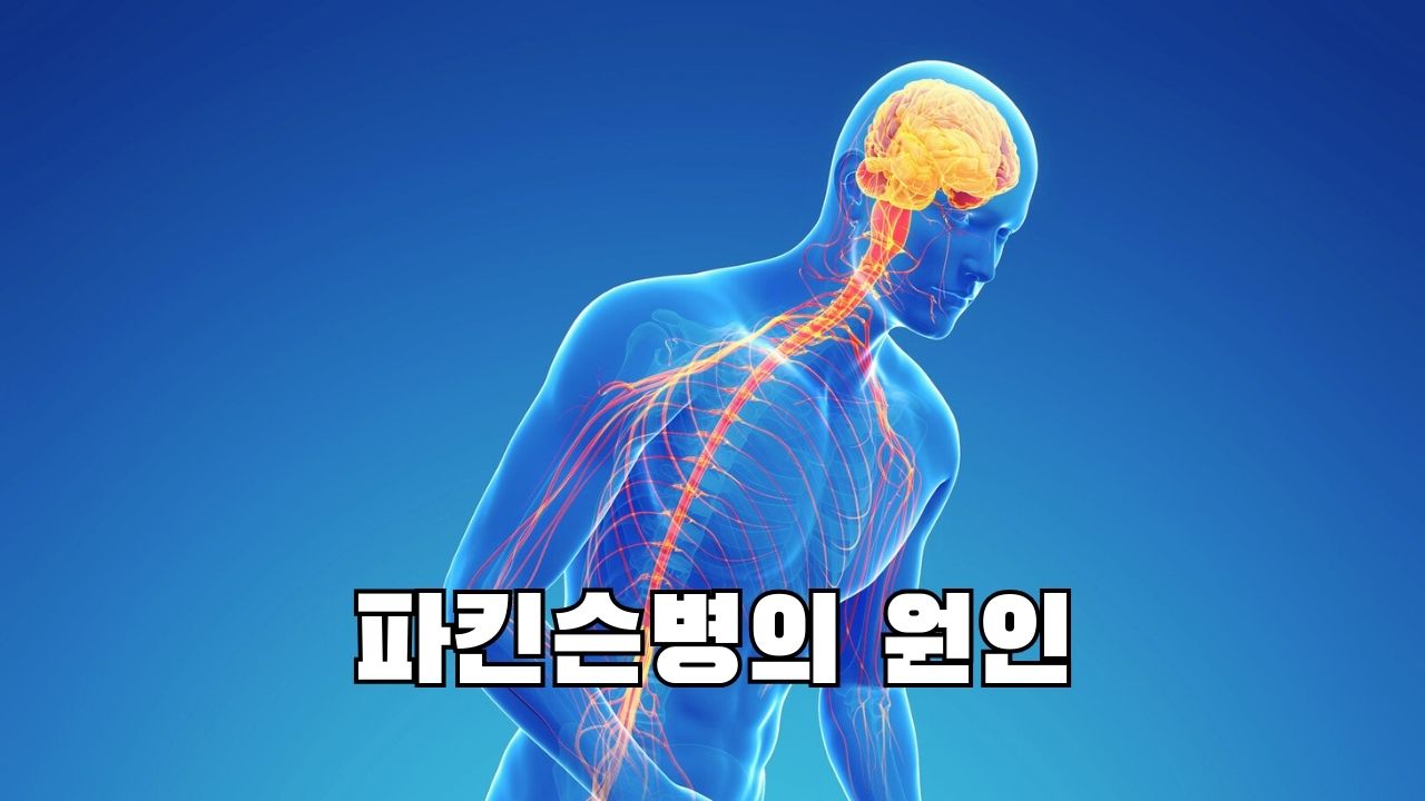 파킨슨병의 원인