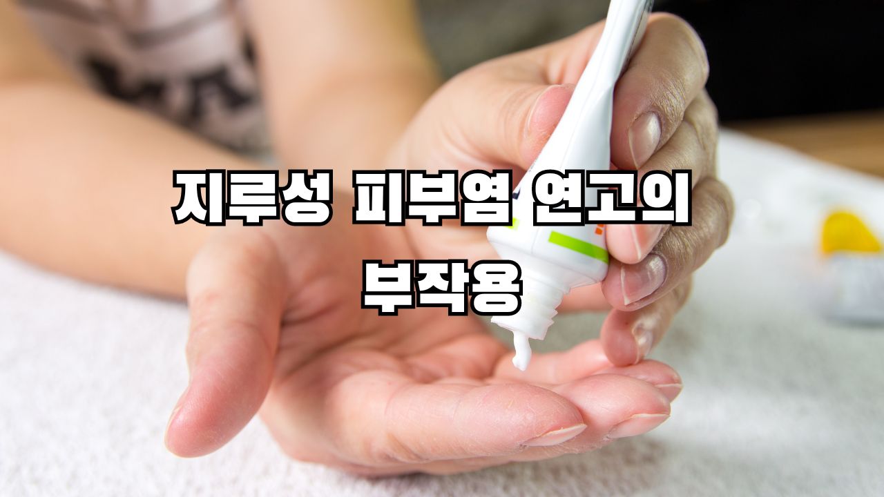 지루성 피부염 연고의 부작용