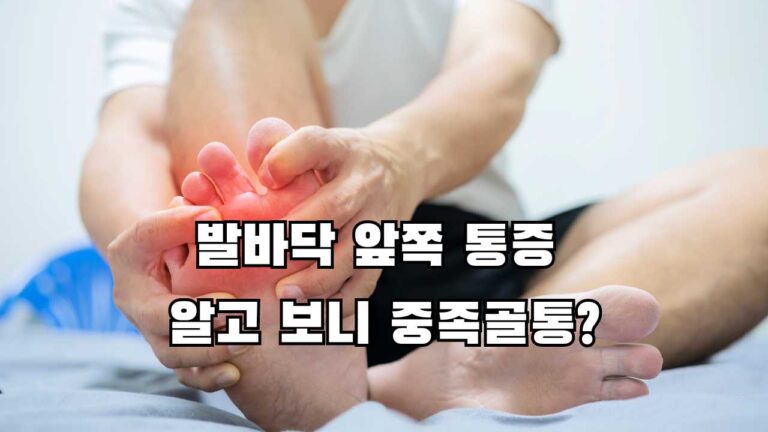 발바닥 앞쪽 통증 알고 보니 중족골통?