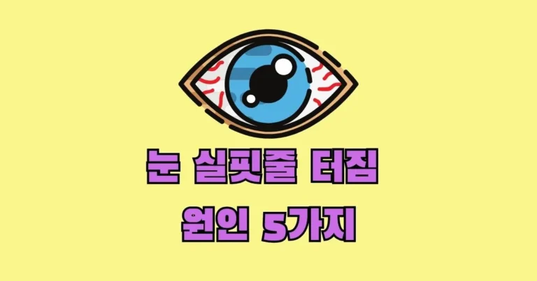 눈 실핏줄 터짐 원인 5가지